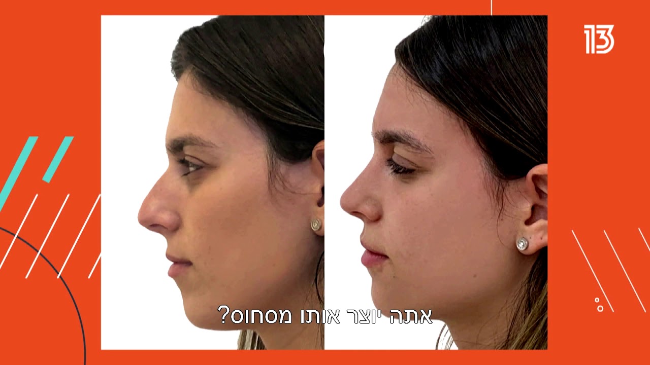 ד״ר יוסי פיכמן מתארח אצל פרופסור קרסו