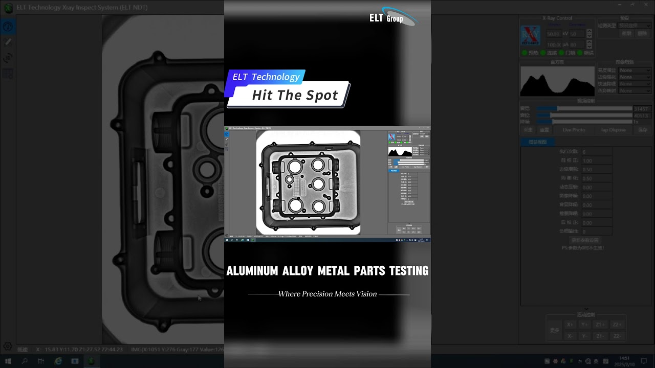 ELT Technology: Intelligent X-ray Expert for Precision Inspection of Aluminum Alloy Components