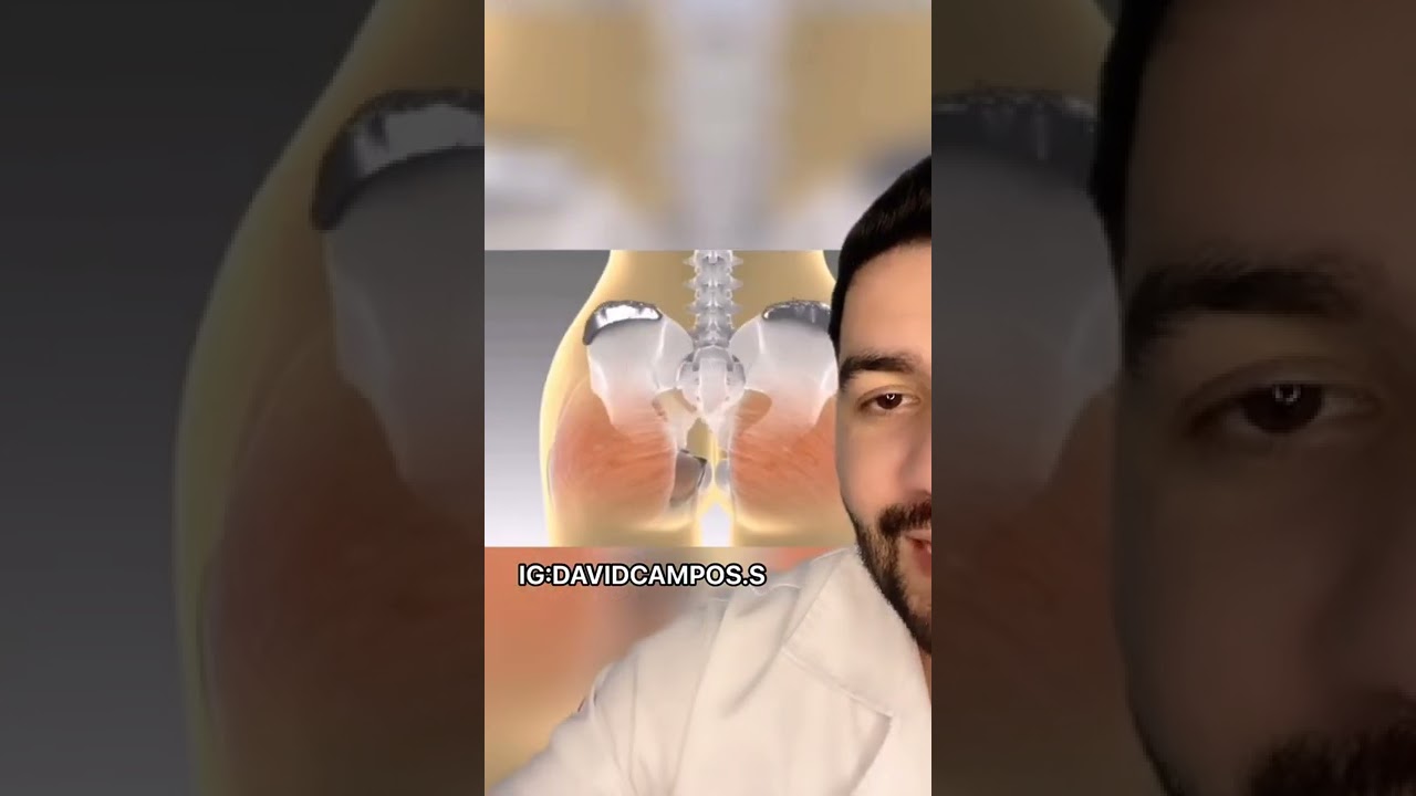 AS&Iacute; PUEDES AGRANDAR TUS CADERAS