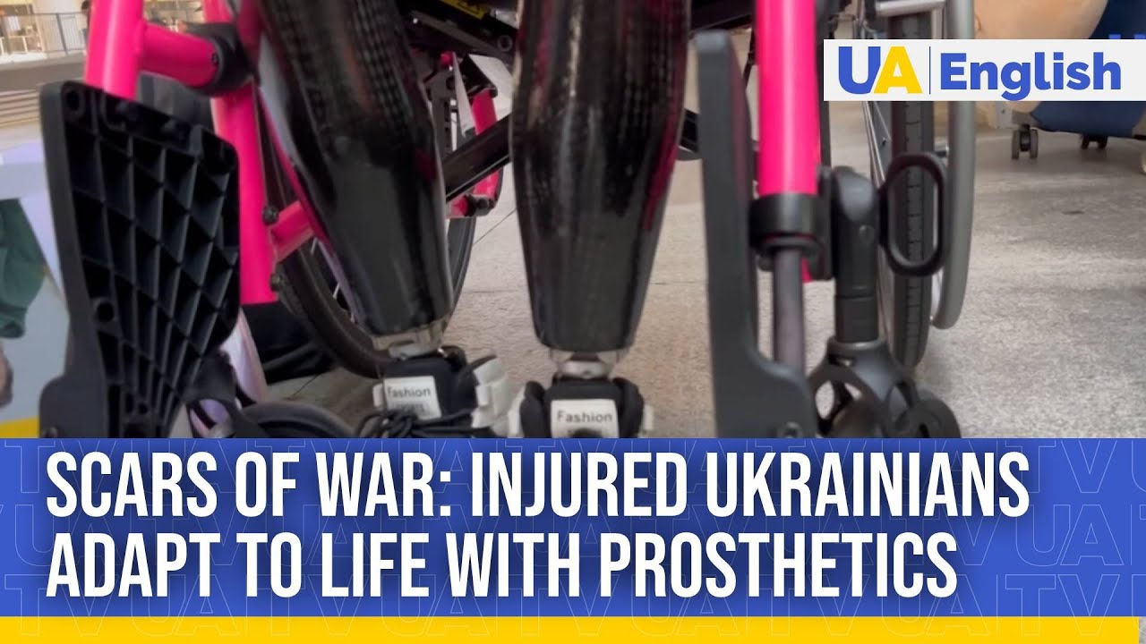 The War Left Them Injured but Did not Break their Spirit