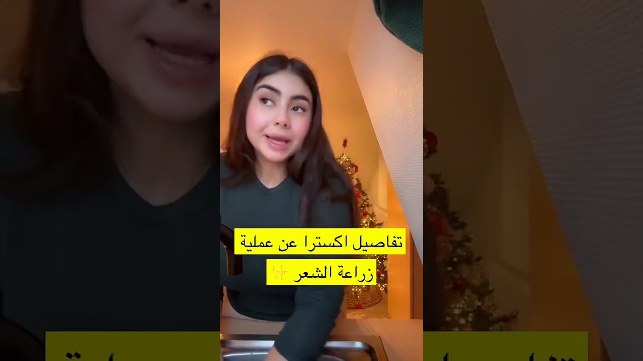 معلومات عن زراعة الشعر عن تجربة موستي