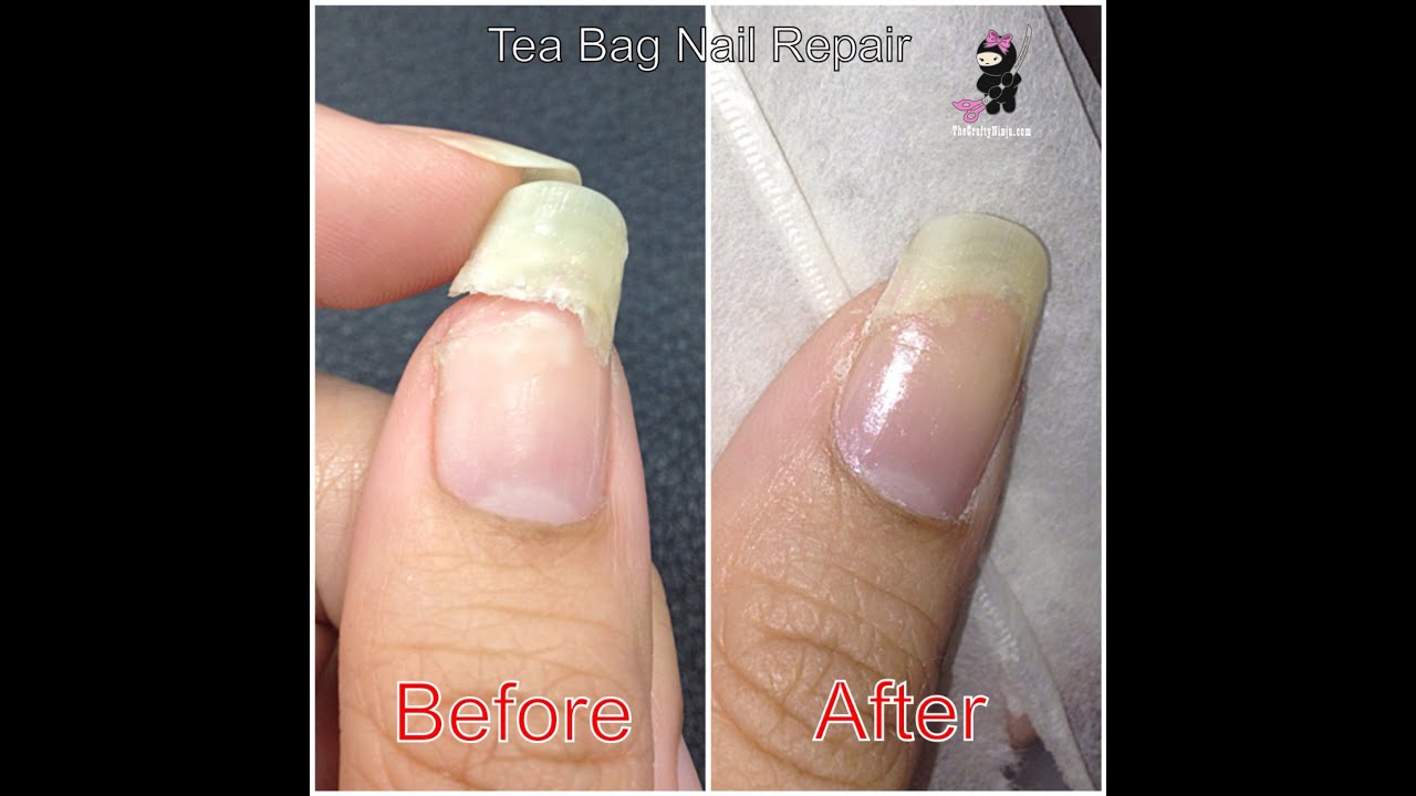 Tea Bag Nail Repair by The Crafty Ninja