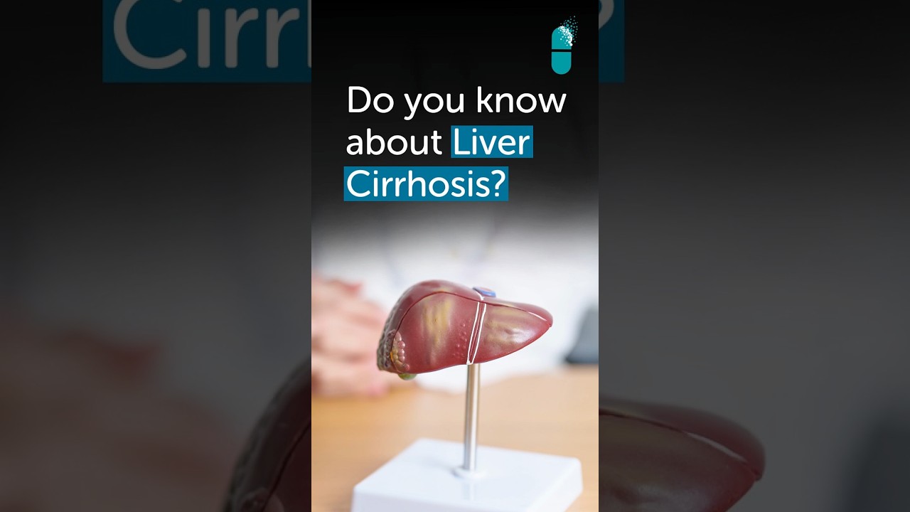 Liver Cirrhosis Without Jaundice: Swelling & Fluid Retention Explained | Gleneagles Hospital