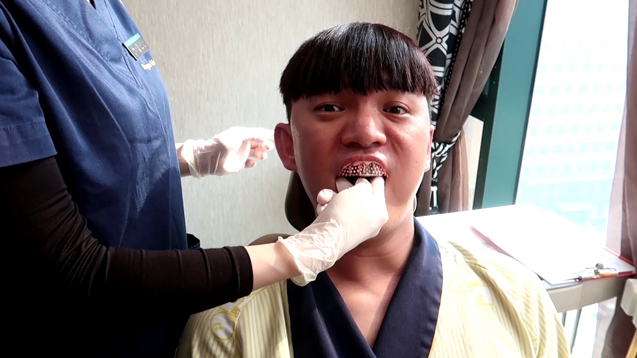 (ENG SUB)Two Jaw(Double Jaw) Surgery in Korea! Plastic Surgery Real Review Part.1