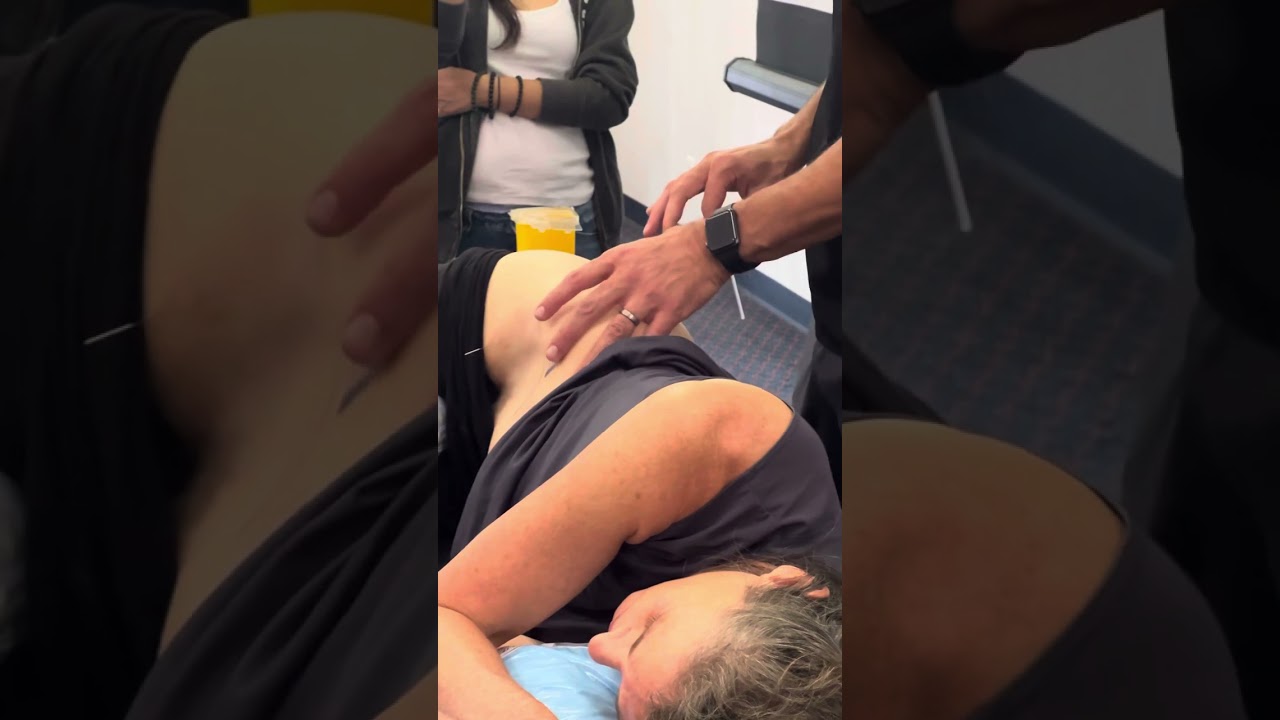 How to treat hip arthritis with electroacupuncture