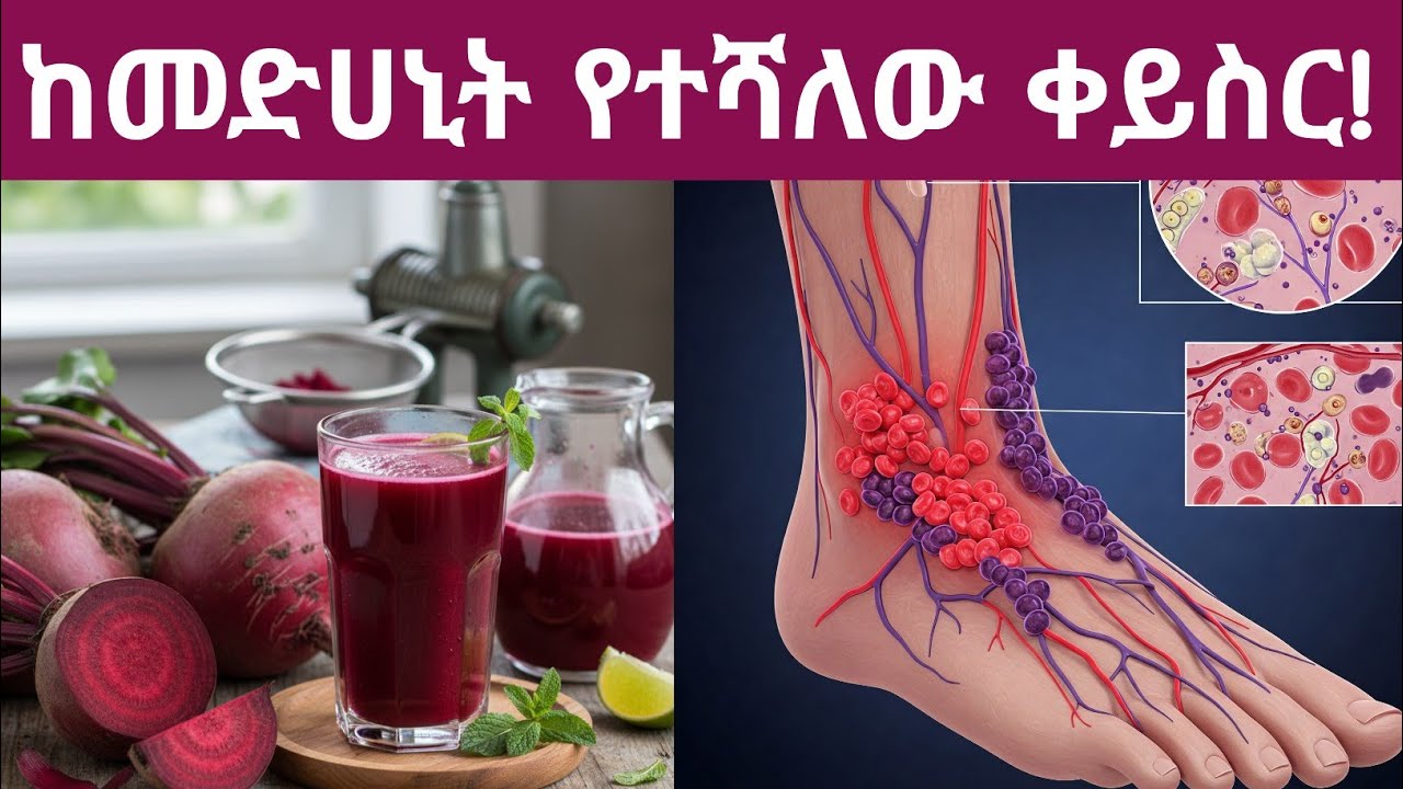 ከመድሀኒት የተሻለው የቀይስር ጁስ አስደናቂ የጤና ጥቅሞች፣አጠቃቀሙ እና ጥንቃቄዎች| beetroot juice benefits and who should avoid