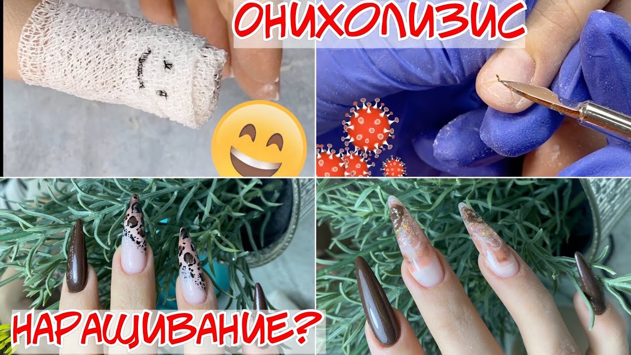Наращивание на верхние формы и онихолизис 🤕😋
