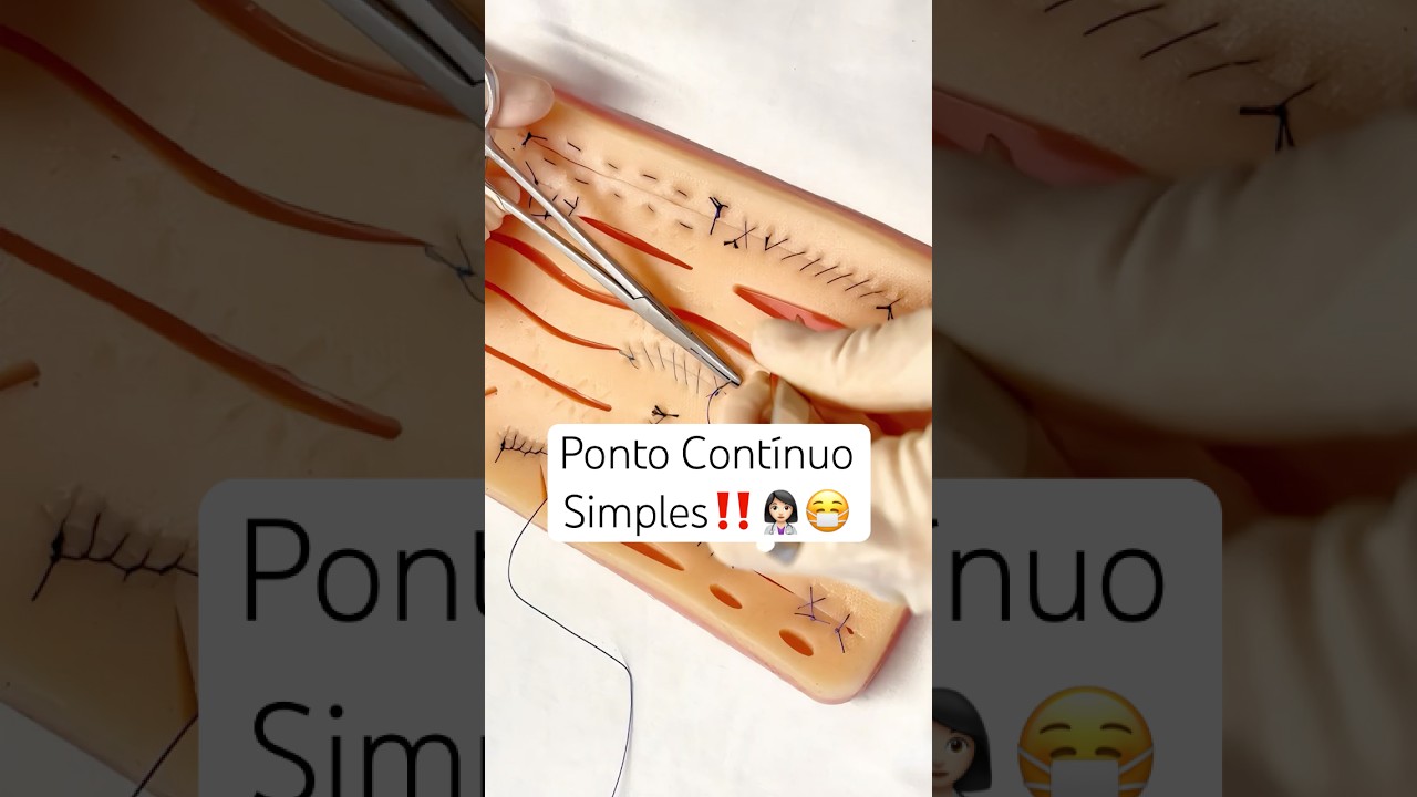 PONTO CONT&Iacute;NUO SIMPLES - Pontos Cir&uacute;rgicos 5