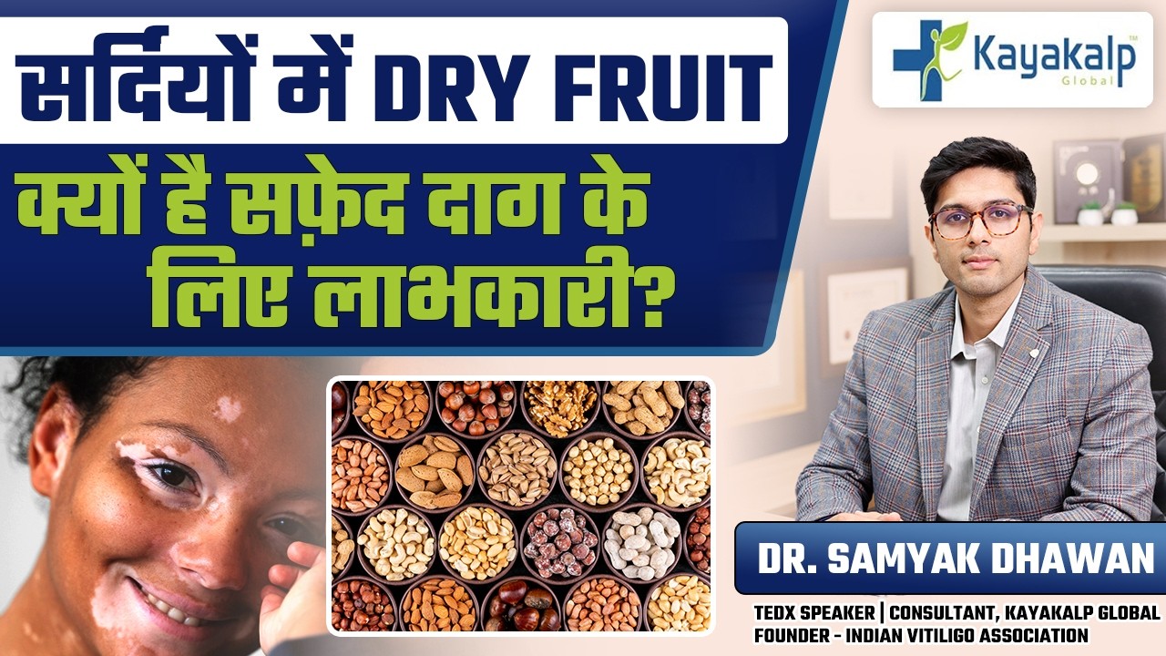 क्या Dry Fruits सच में ठीक करते हैं सफ़ेद दाग? सच जानें आज! | Kayakalp Global Vitiligo Treatment