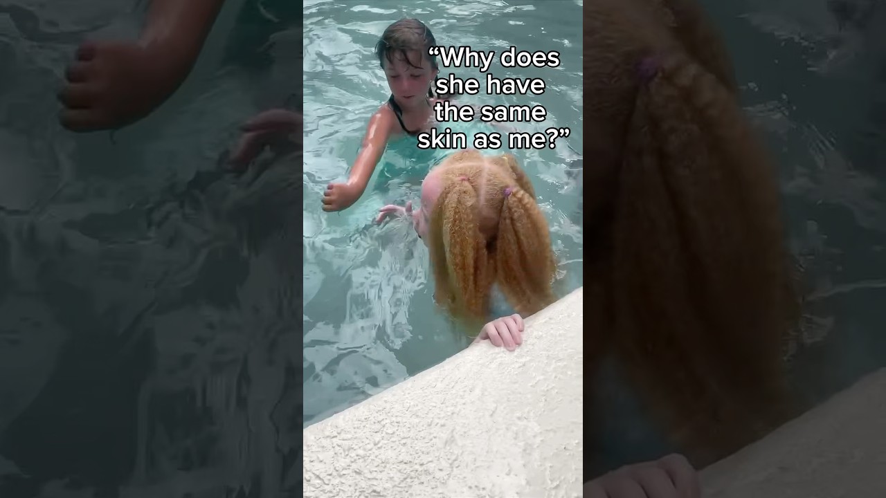 Дети часто задают мне этот вопрос: &laquo;Это ваш ребёнок?&raquo; #альбинизм #альбинос