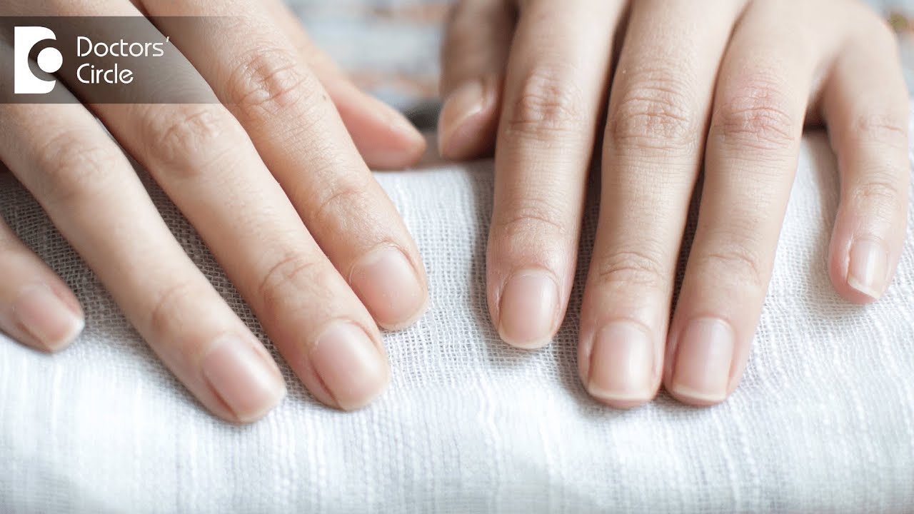 Causes of nails turning white partially or fully - Dr. Amee Daxini