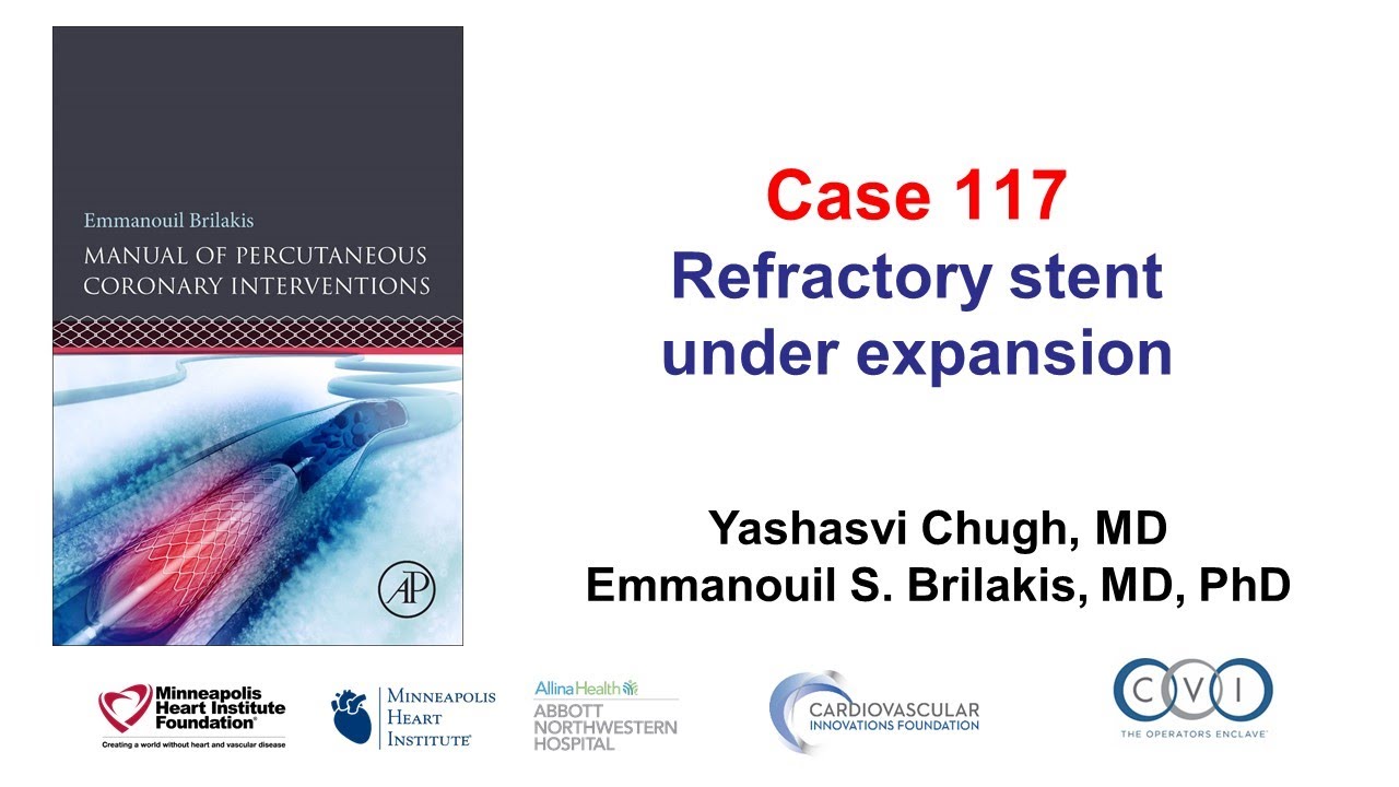 Case 117: PCI Manual - Refractory stent underexpansion