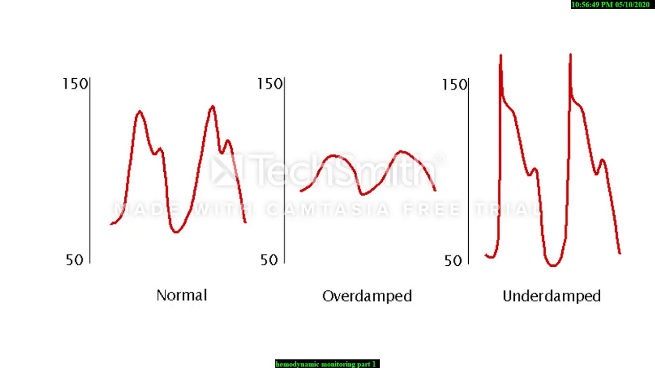 Hemodynamic monitoring part 1 (Arterial line) | Dr Jayram Navade | Dr Anuja Dharmale