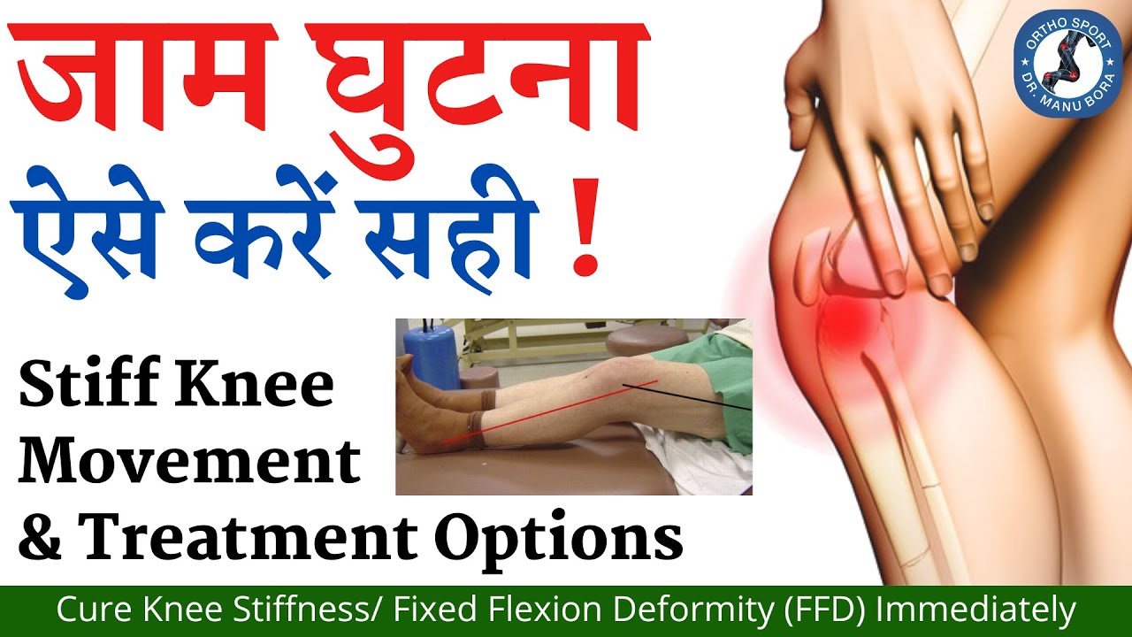 जाम घुटना – कैसे करें सही ? Stiff Knee Movement & Treatment Options, Cure Knee Stiffness Immediately