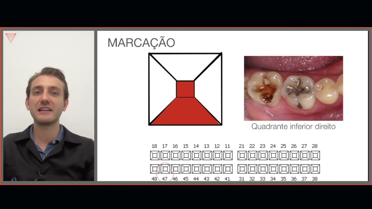 Odontograma em Odontologia