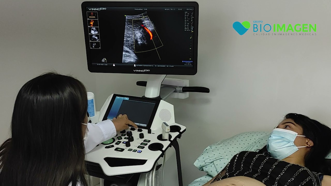 Optimización del Color Doppler en la Arteria Uterina del VINNO E30 - Ginecología