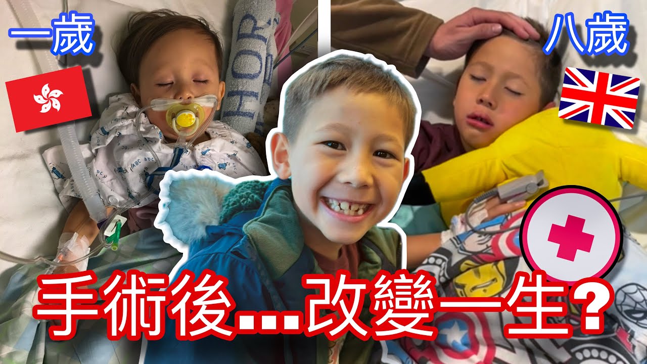 混血兒子在英國動手術了... 然後呢？效果沒有預期中好... 英國呼吸道動手術後Q&A “Magical” Recovery from UK Surgery…