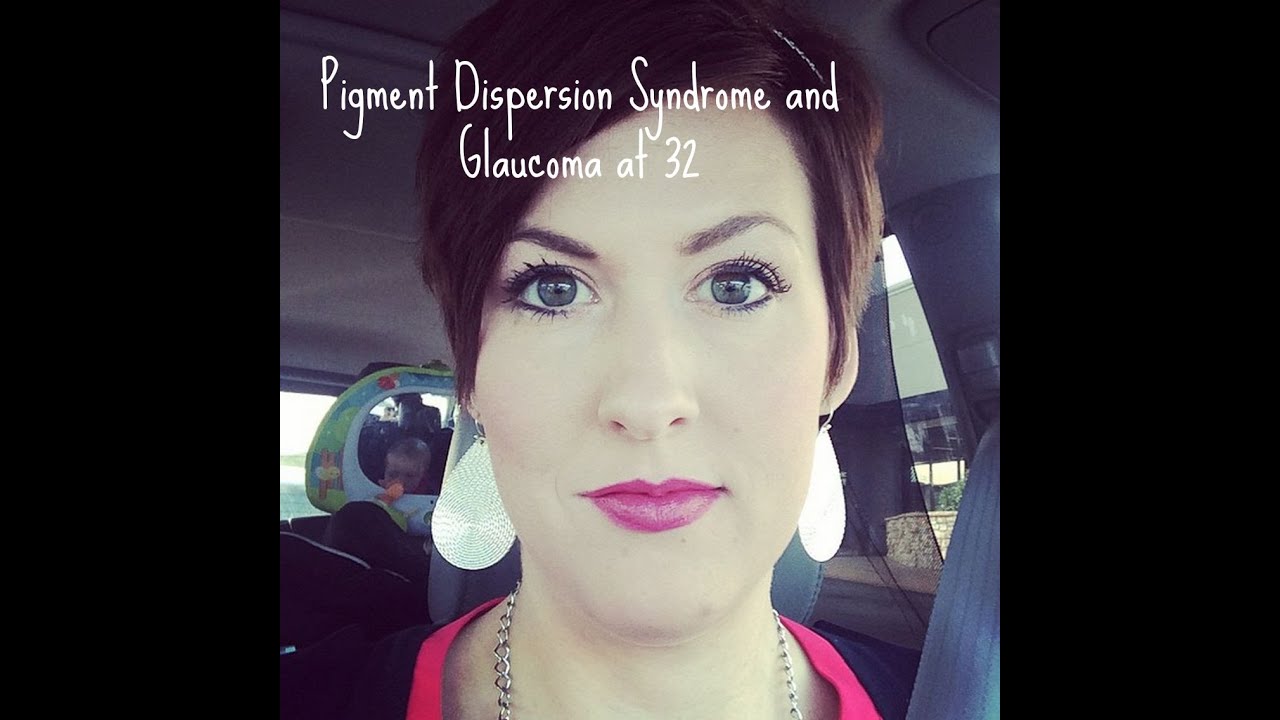 Pigment Dispersion Syndrome & Glaucoma