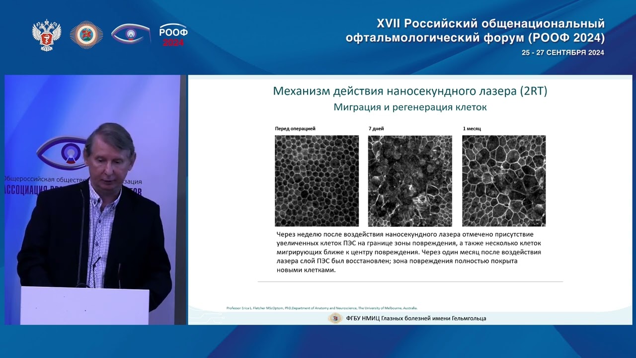 Российский опыт применения нетепловой репаративной терапии сетчатки 2RT