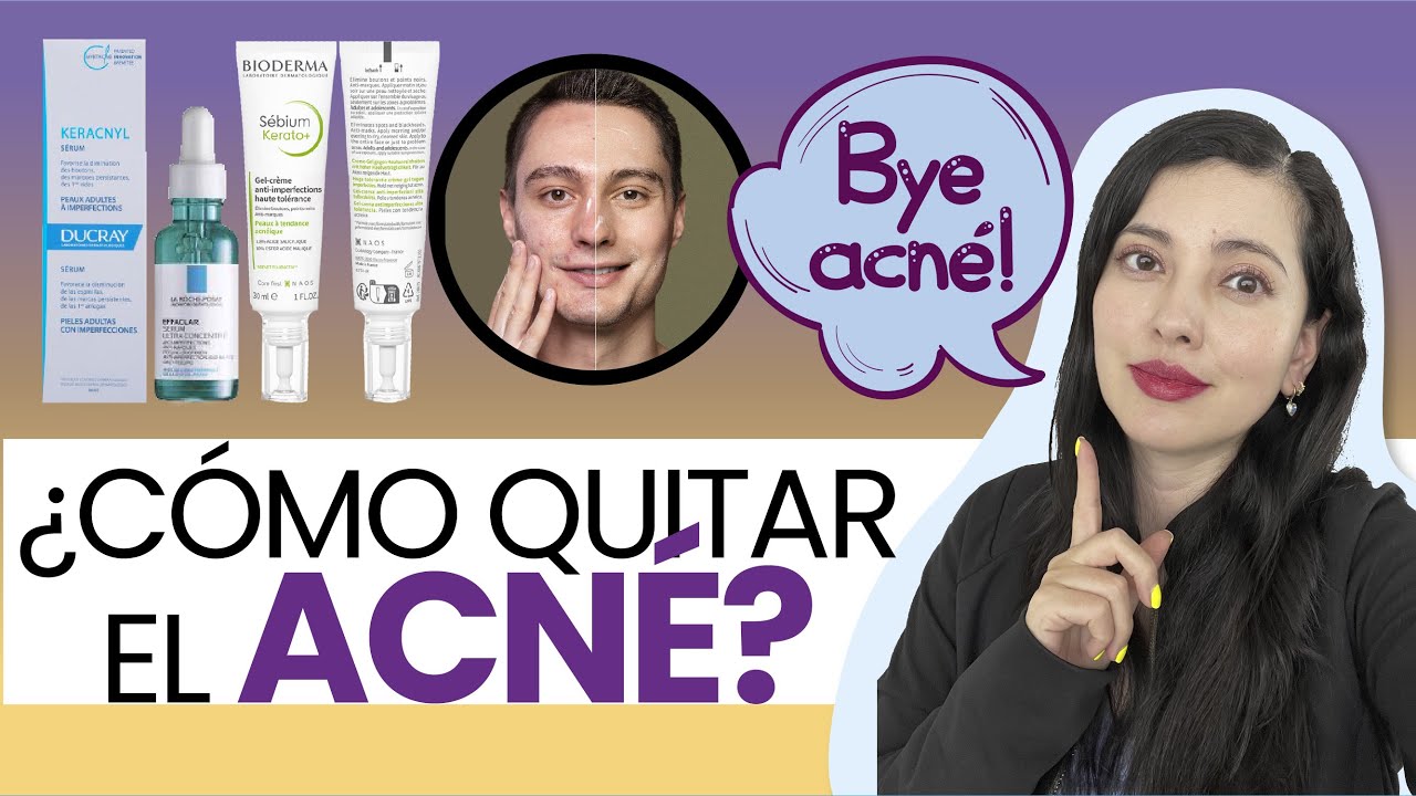 COMO QUITAR EL ACNÉ, Tips de una DERMATÓLOGA