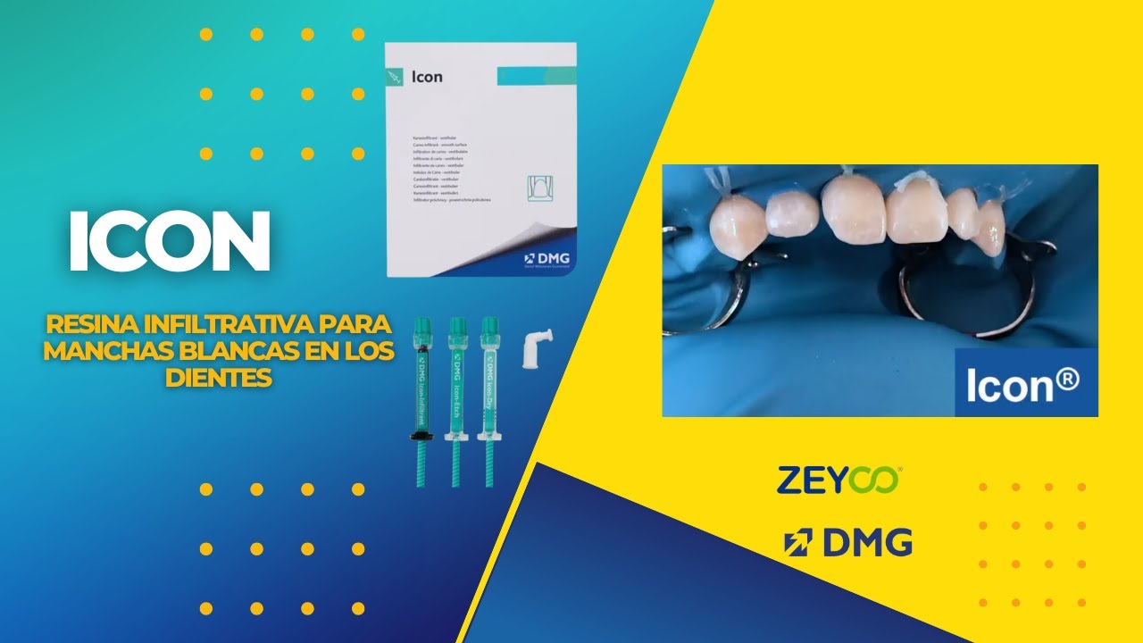 ICON 🦷  Resina Infiltrante para manchas blancas