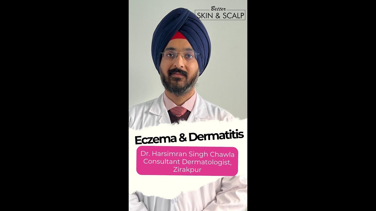 Do's & Don'ts in Eczema by Dr. Harsimran Singh Chawla, Consultant Dermatologist, Zirakpur