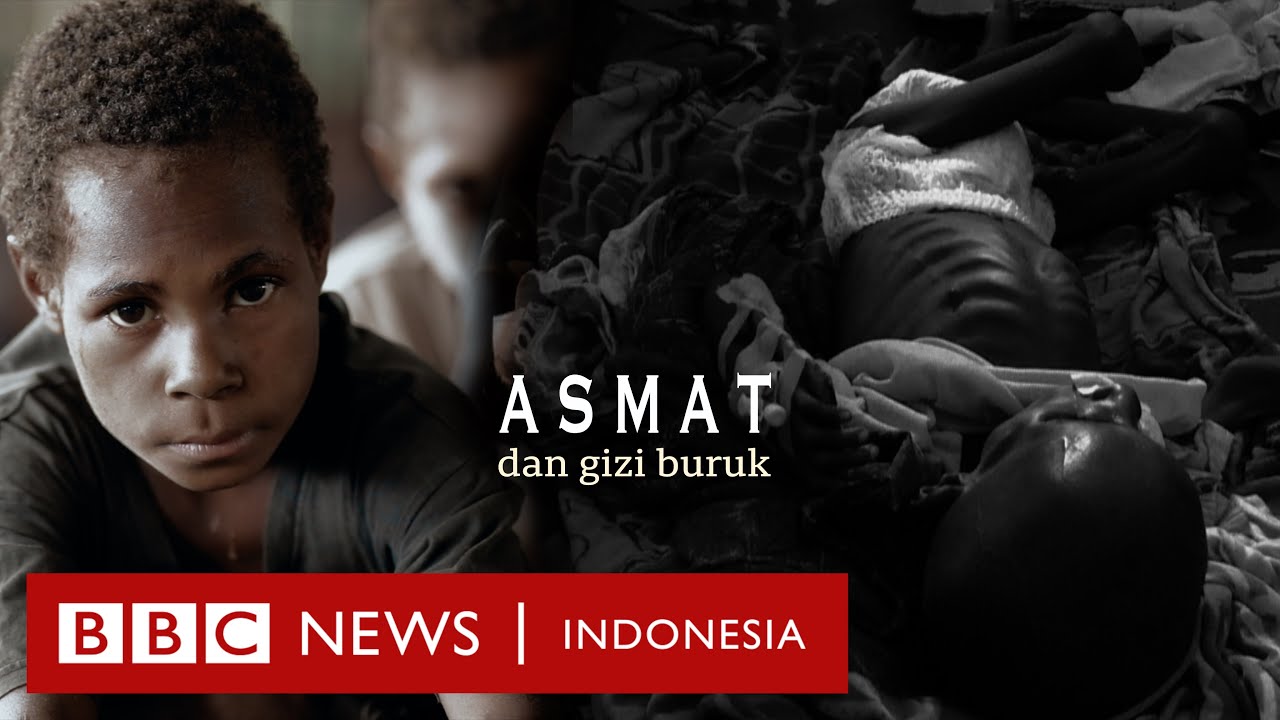 Papua: Mengapa masalah gizi buruk masih menghantui Asmat? - BBC News Indonesia