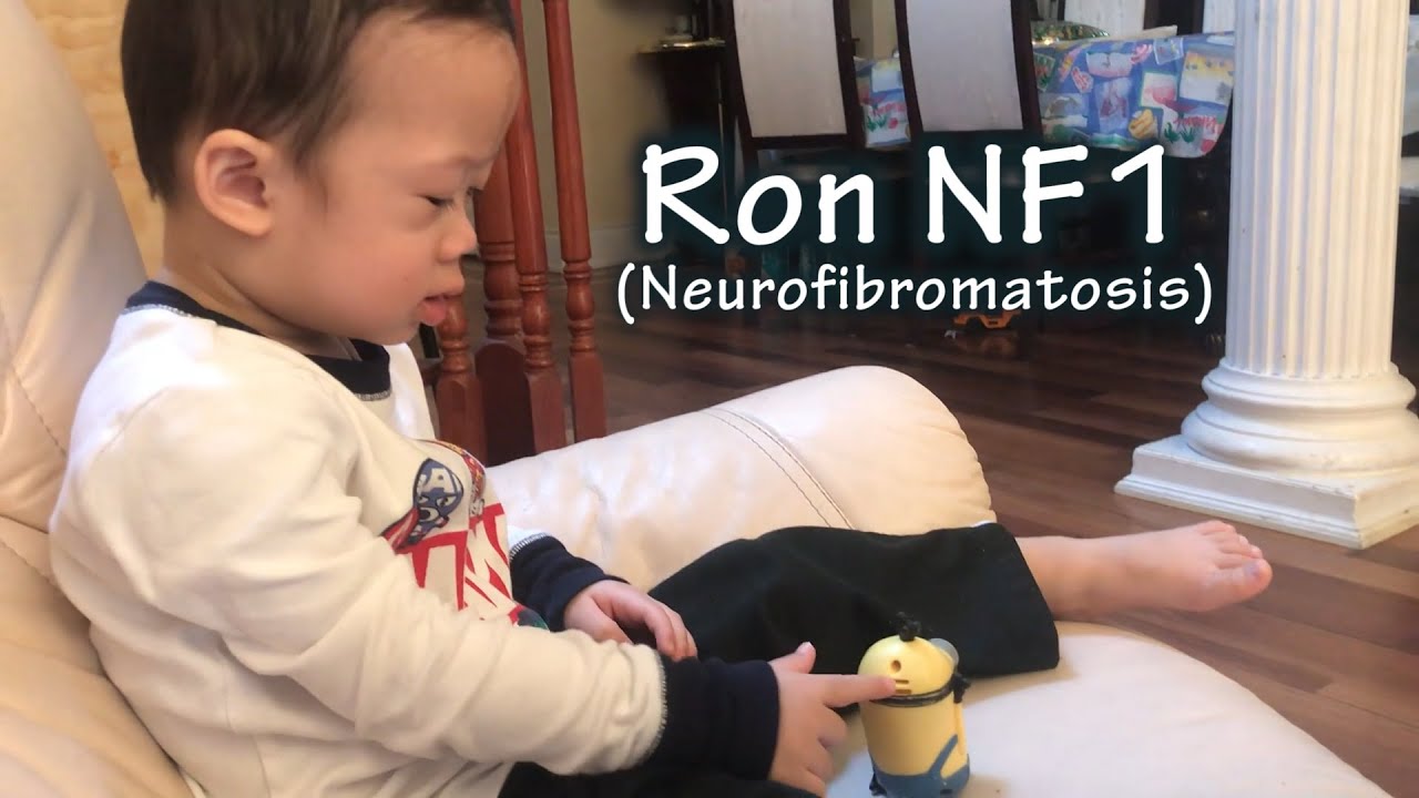 Your child got NF1 (Neurofibromatosis)
