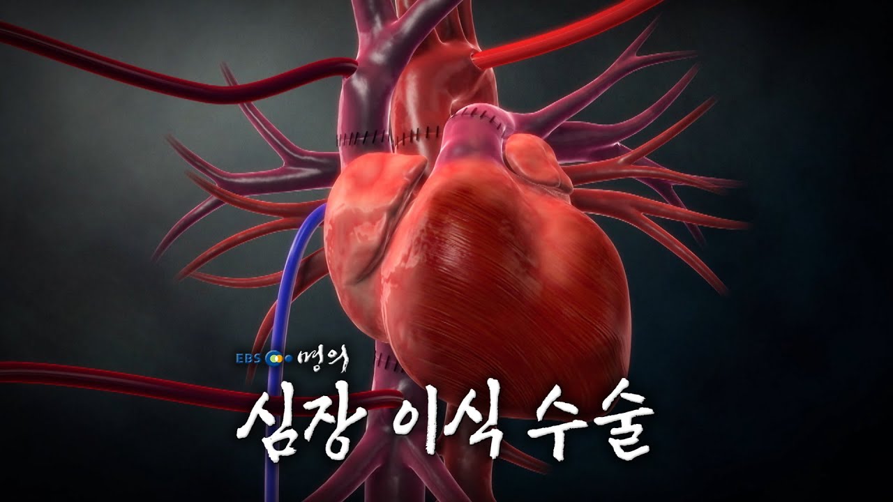 [명의 의학백과📖] 심장 이식 수술