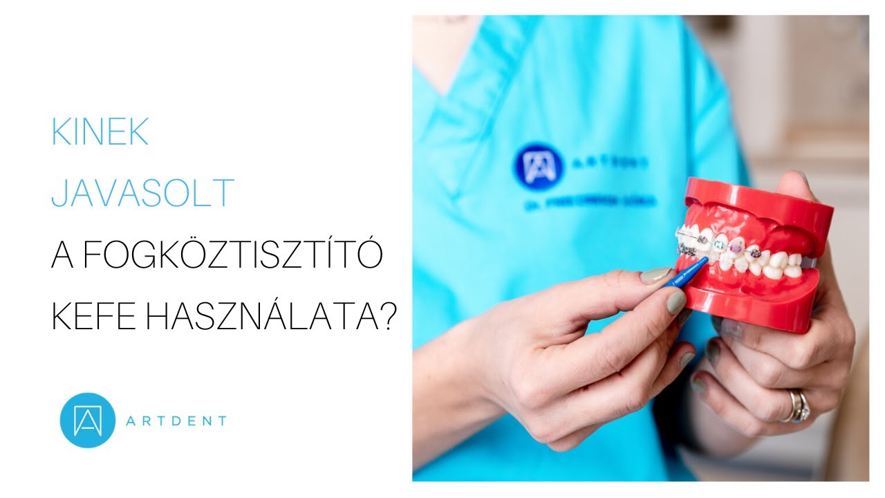 Kinek javasolt a fogköztisztító kefe használata?