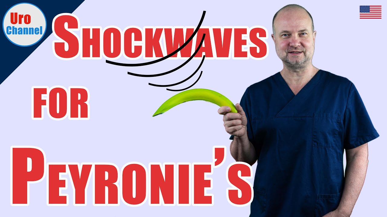 Shockwave therapy (ESWT) for Peyronie's disease | UroChannel