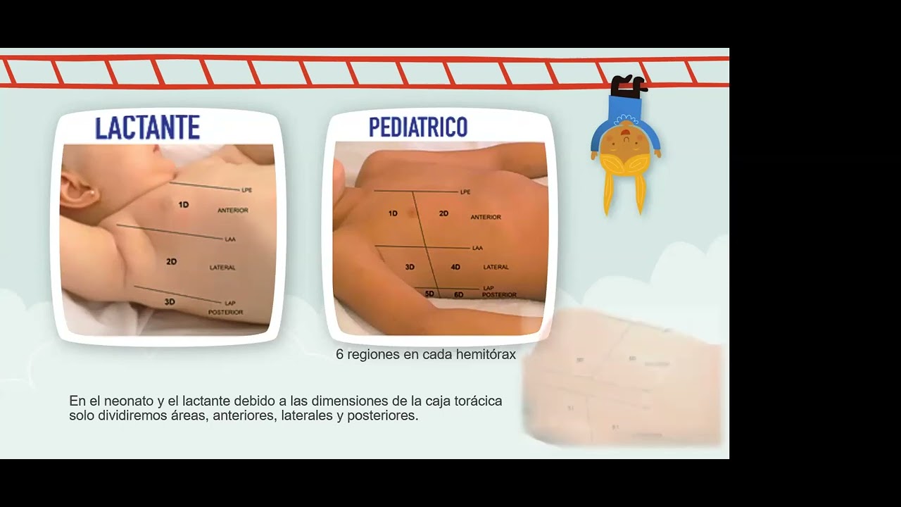 07.2022 Ecografia pulmonar pediatrica en Quirófano. Dra. Karla Gutierrez, Dr.  Hector Mejia (MEX)