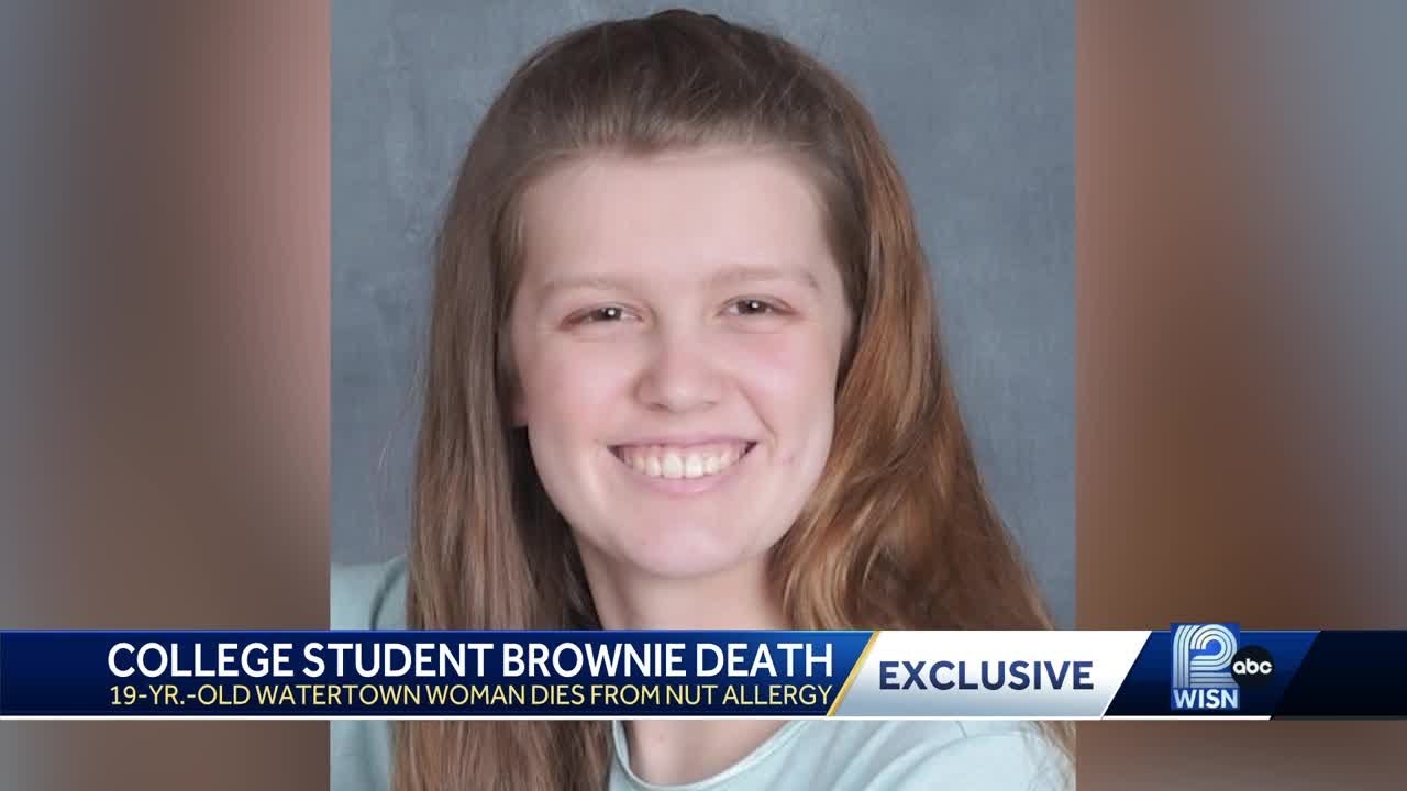 Watertown college student dies from peanut allergy
