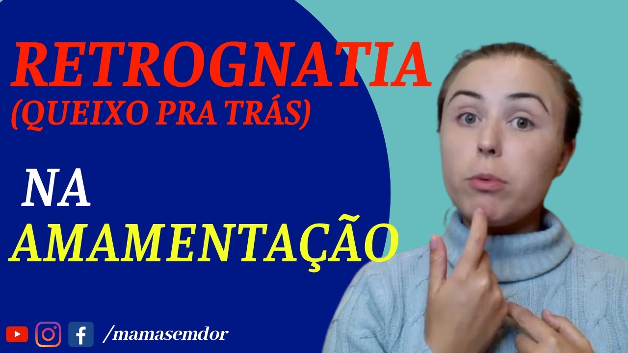 Saiba como o QUEIXO do BEBÊ pode ATRAPALHAR a AMAMENTAÇÃO! Retrognatia do bebê, 