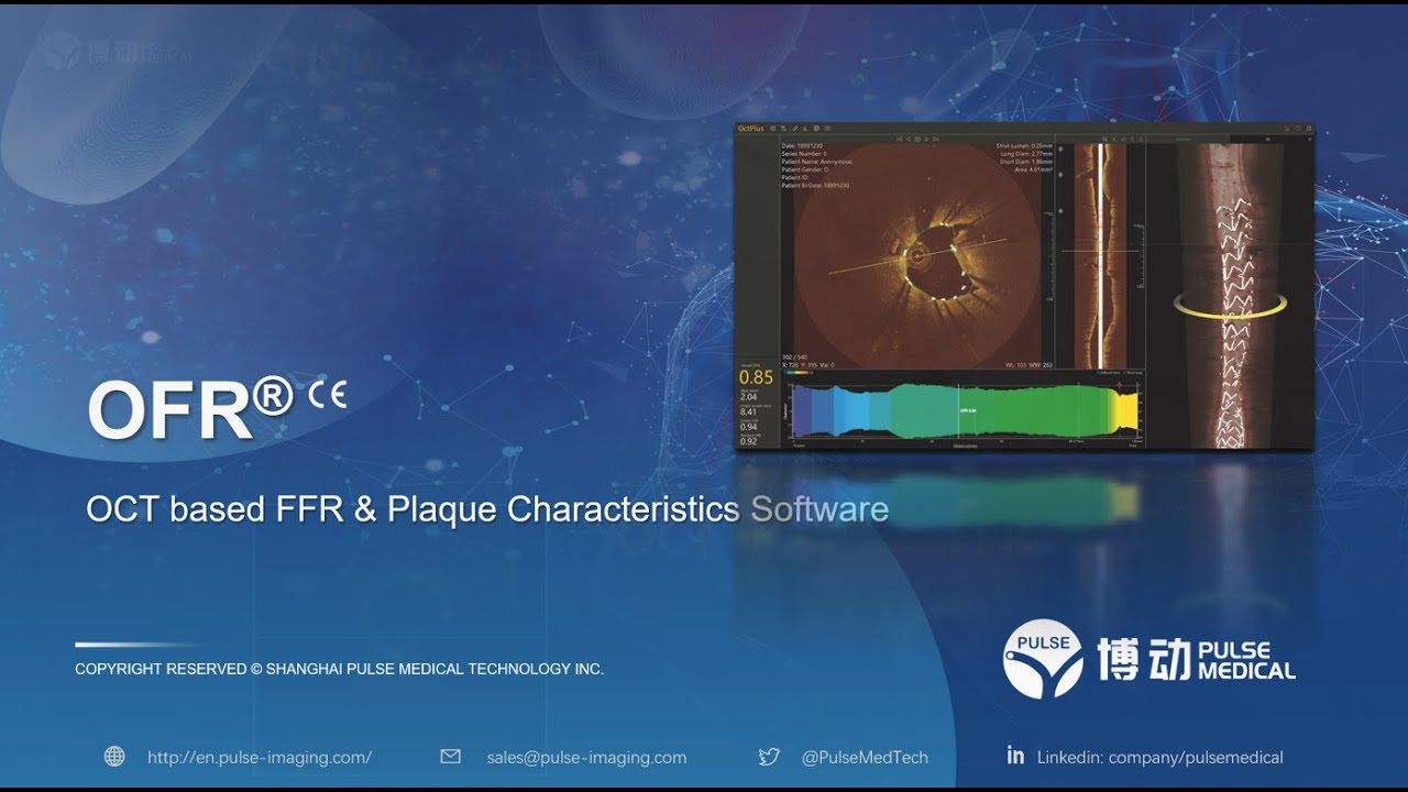 OFR OCT-based FFR & Plaque Characteristics, OctPlus @ Pulse Medical