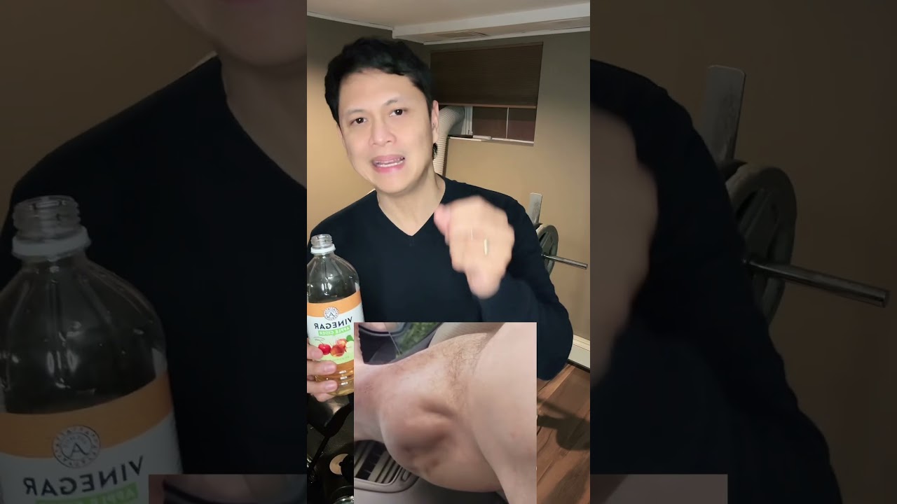 Muscle Cramps or Pulikat? Anu dapat gawin.. #musclecramps