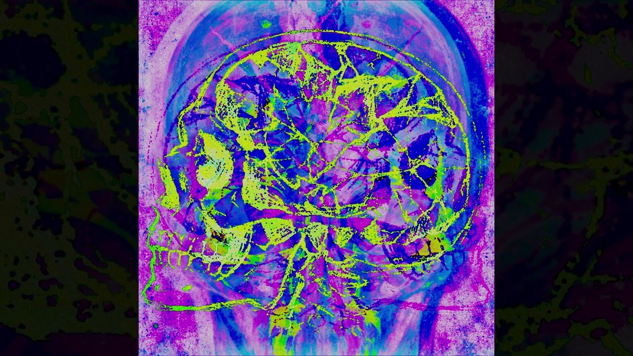 X-ray