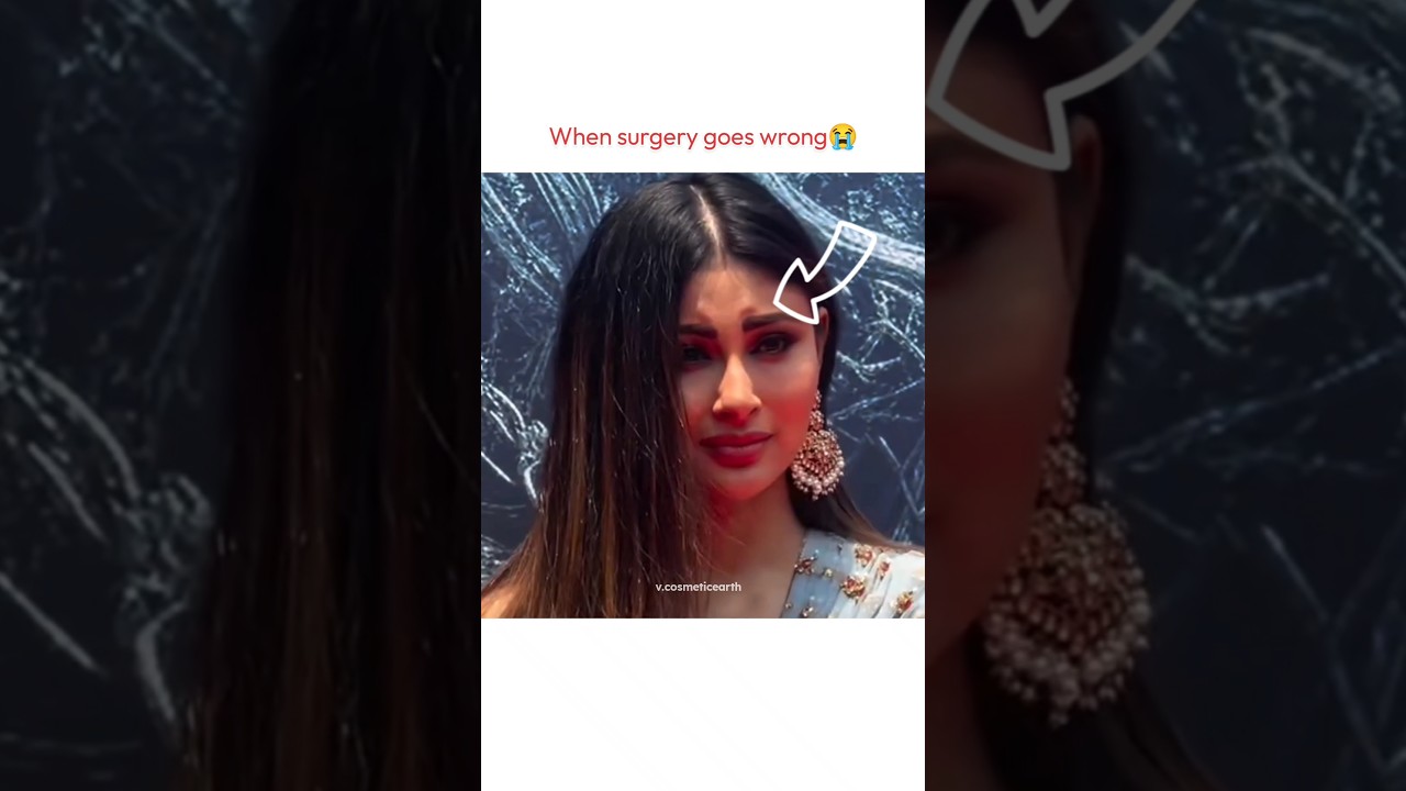 When Surgery goes wrong💔😢#shorts #mouniroy #transformation #bollywood #celebrity#botox
