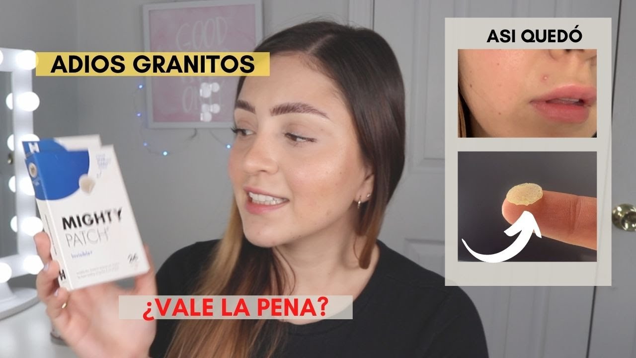 Parches para acné de Cosmetics Hero, Funciona? | Soyangiefarfan