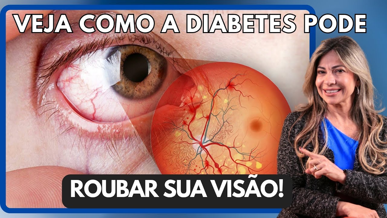 Sa&uacute;de Ocular no Novembro Azul: Dicas para Prevenir a Retinopatia&nbsp;Diab&eacute;tica