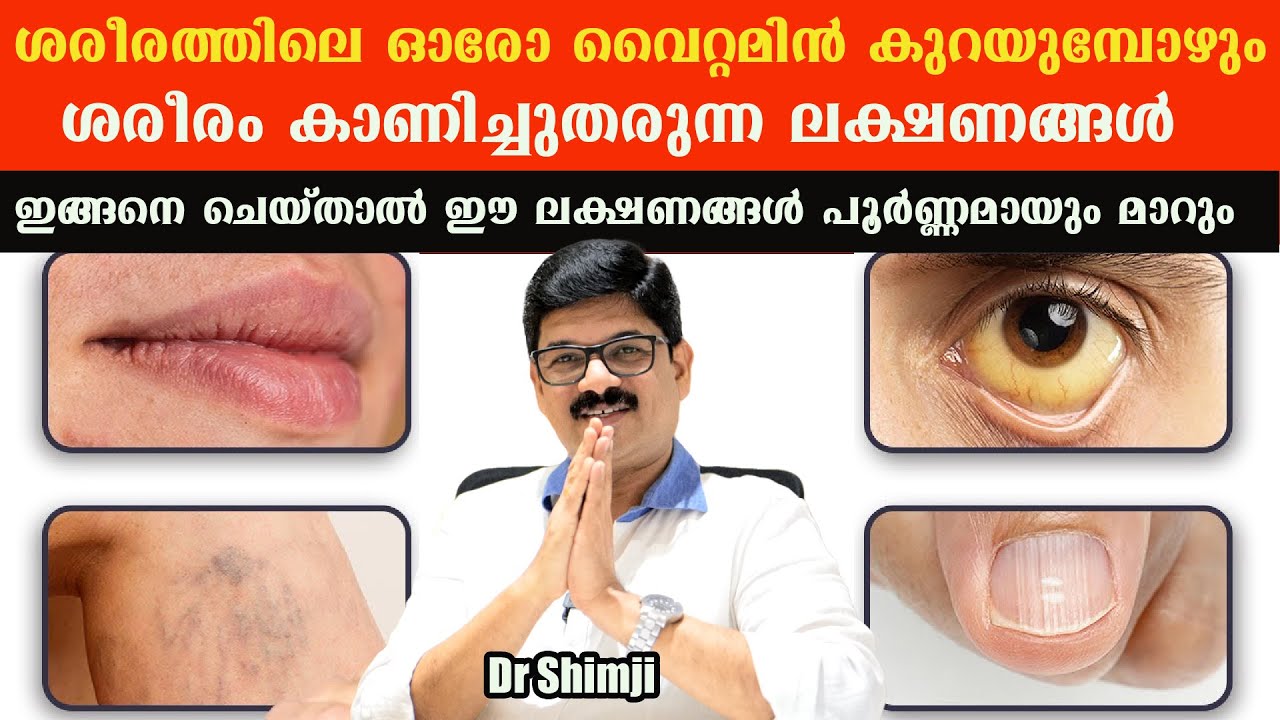 ശരീരം കാണിക്കുന്ന ഈ ലക്ഷണങ്ങൾ അവഗണിക്കുന്നത് നിത്യരോഗം വിളിച്ചുവരുത്തുന്നതിനു തുല്യം /Dr Shimji