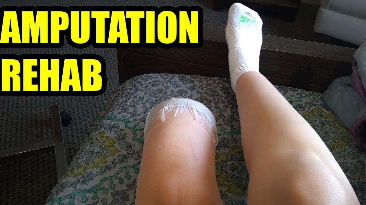 Pros & Cons: Rehabilitation Center after Amputation