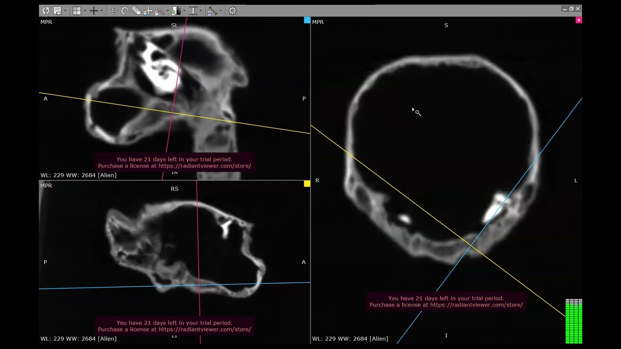 Nazca "alien" mummy "Josephina's" DICOM images with 3D multi-planar reconstructions -- PART 6