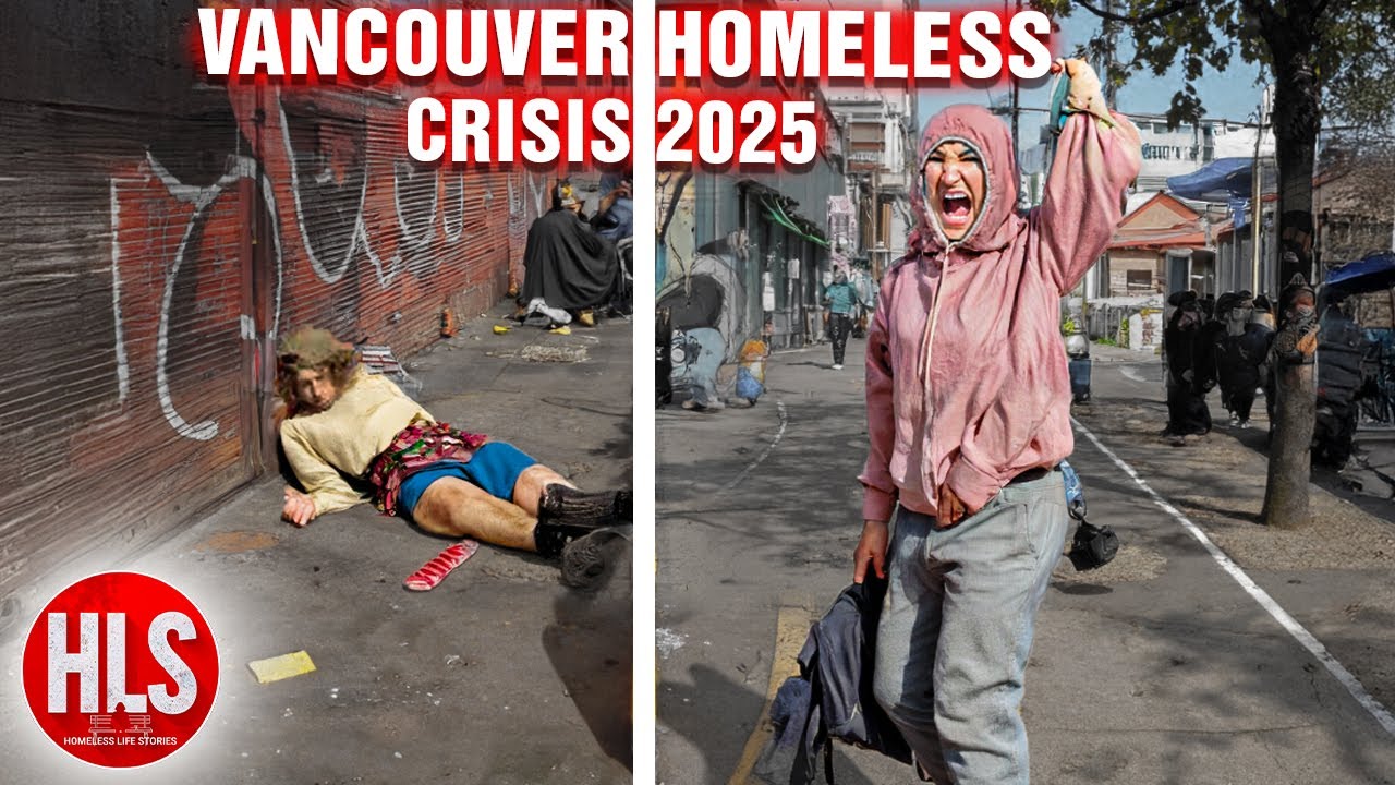 Canada Homeless Crisis 2025: Vancouver’s Forgotten Lives, Rising Costs, and Hidden Homelessness