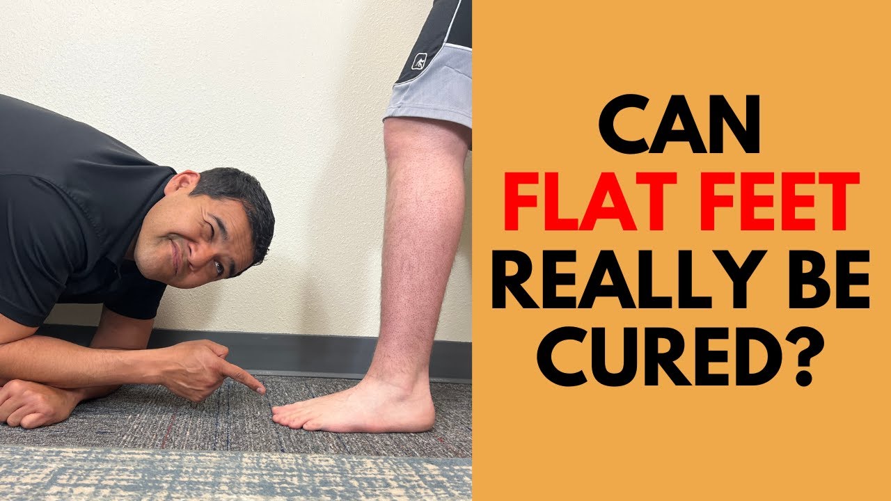 Can Flat Feet Really Be Cured? Everything You Need To Know