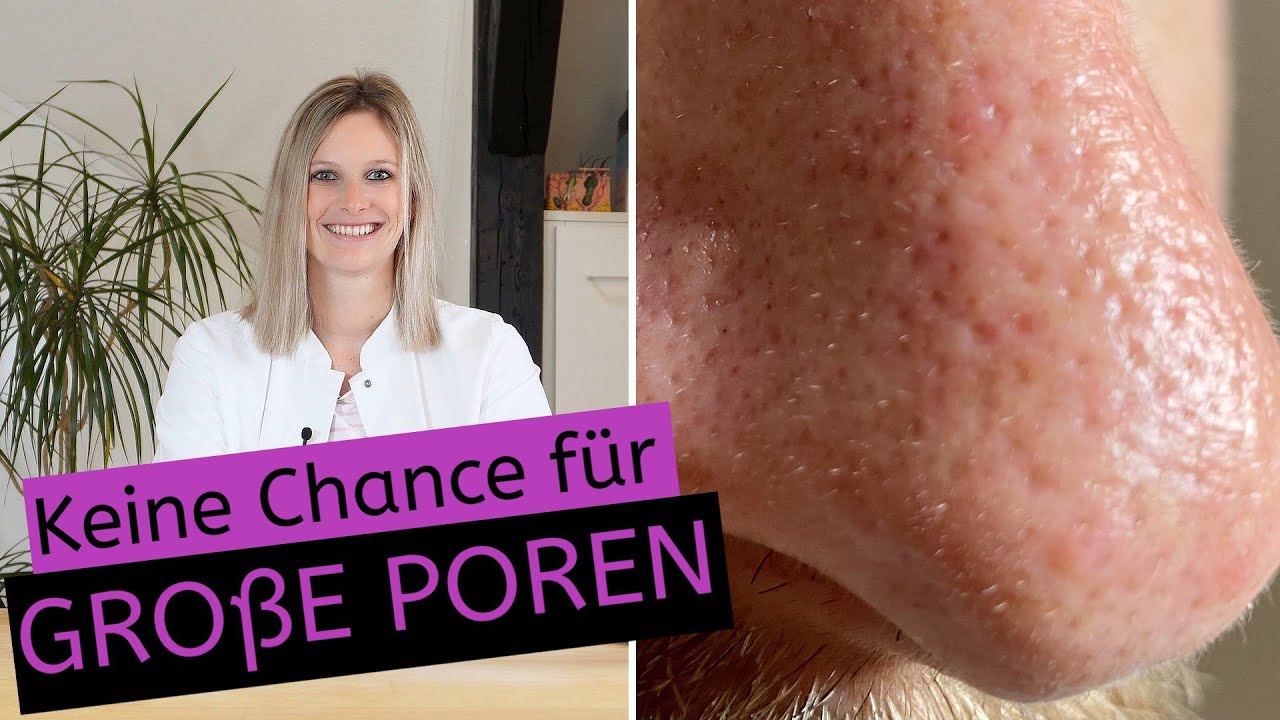 [4K] Schluss mit großen Poren | Ursachen | Vorbeugung | Kosmetik | Therapie