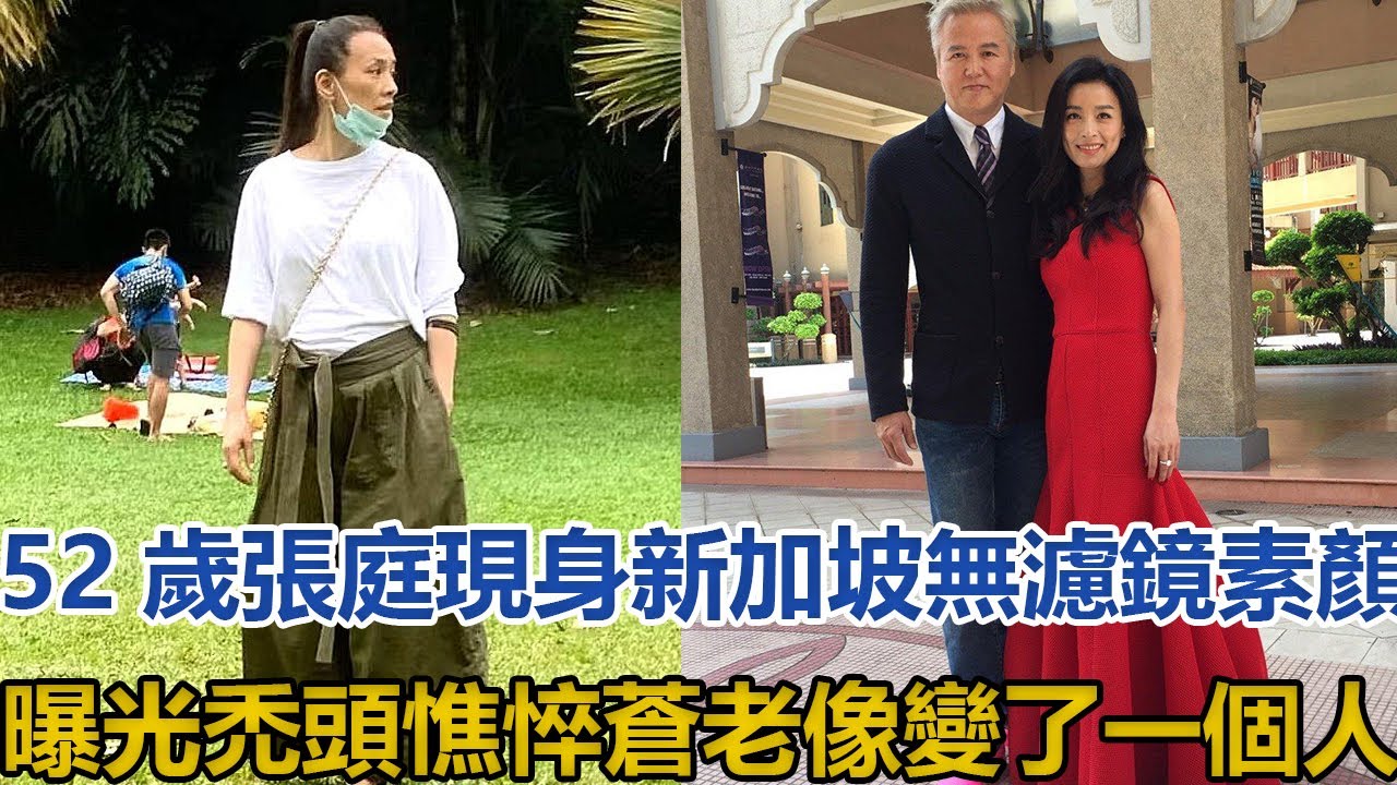 52歲張庭現身新加坡，無濾鏡素顏曝光，禿頭憔悴蒼老像變了一個人#張庭#林瑞陽