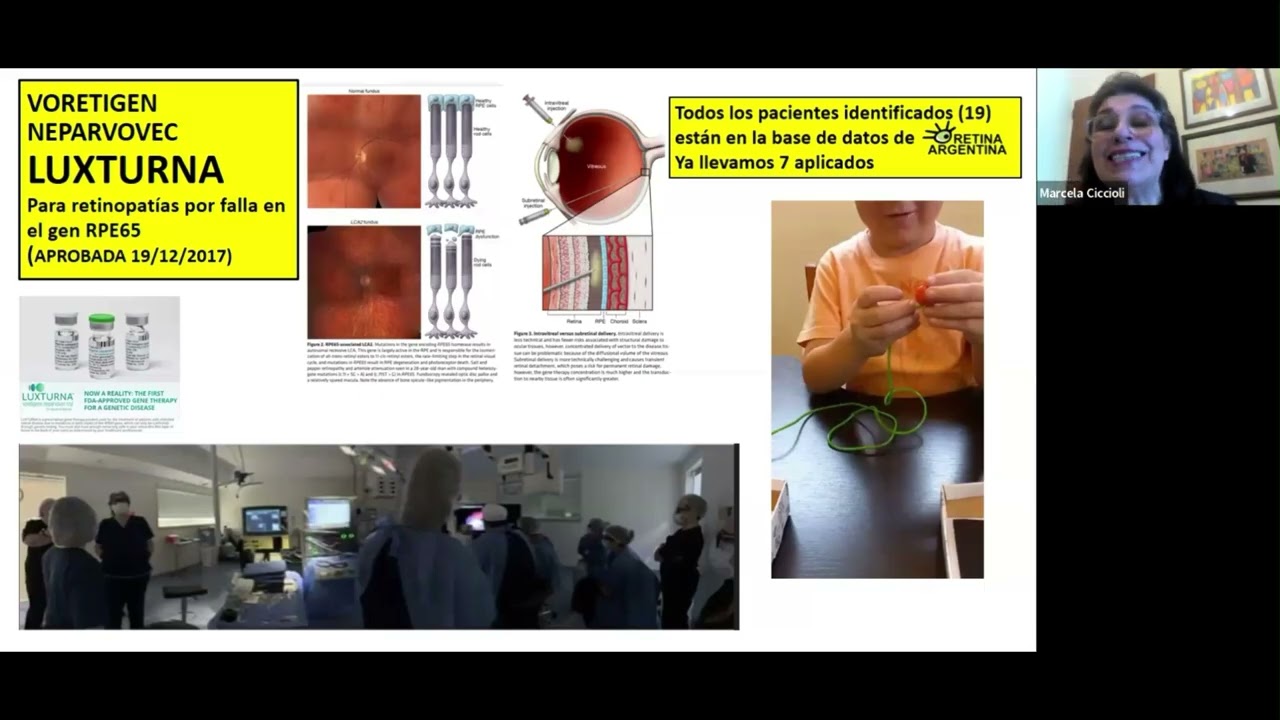 Webinario Retina Argentina 2025 -Segunda Parte