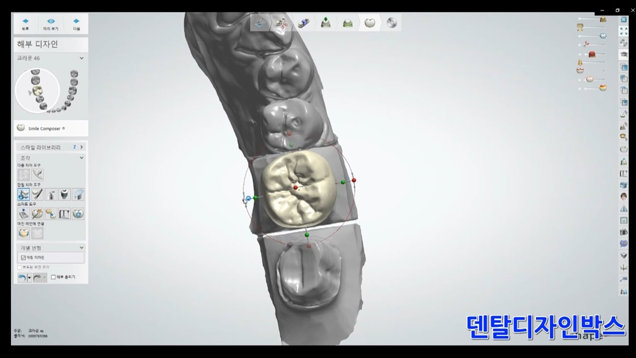 초보도 10분만에 배우는 3shape 싱글크라운(single crown)디자인 방법! 여러가지 기능 빼고 딱 필요한 기능만!
