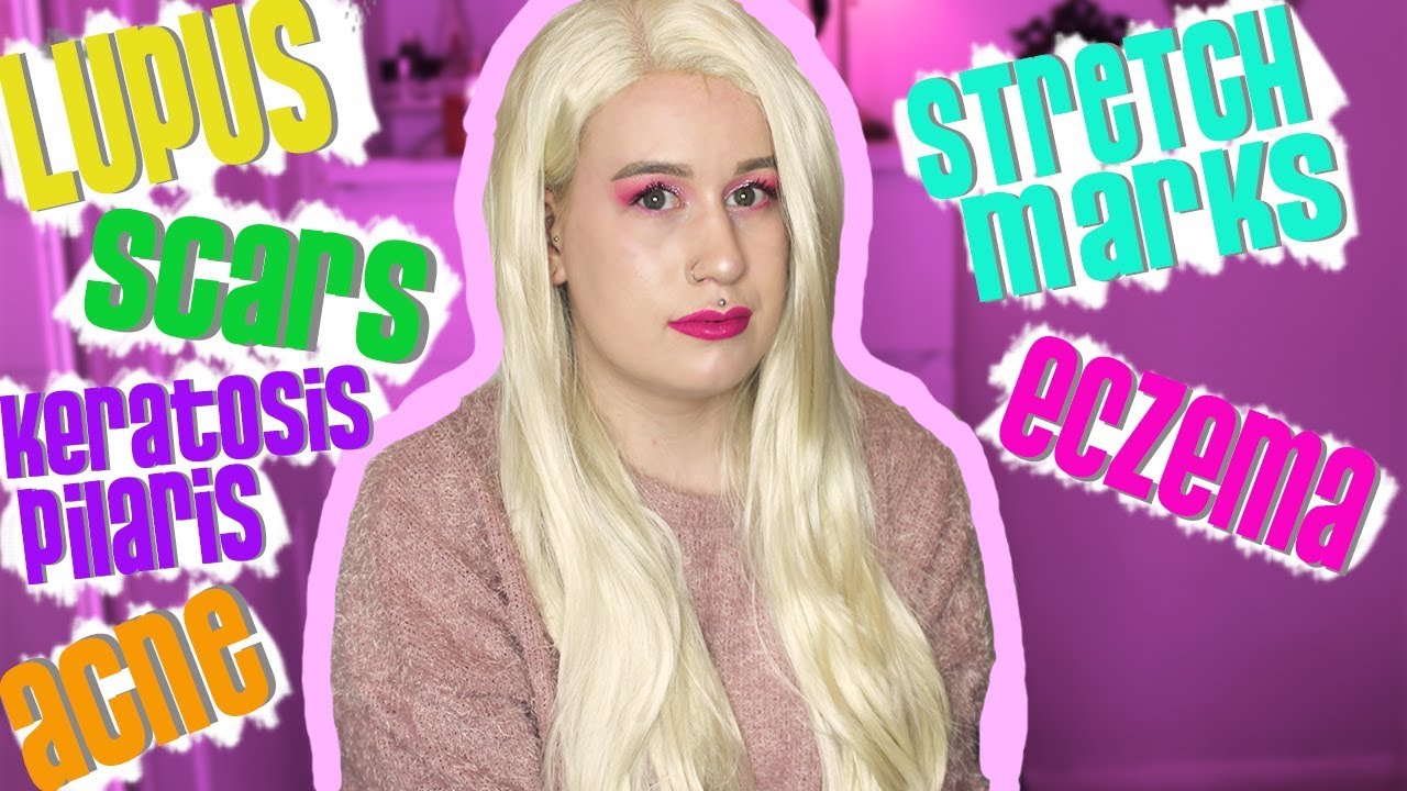 Getting Problematic Skin Tattooed | My Subscribers Experiences & Advice